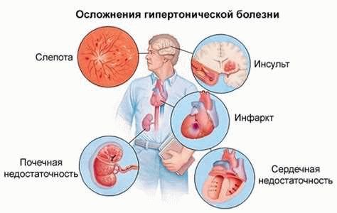 Выявление и определение ВЧД на медицинской комиссии