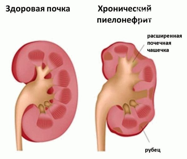 Как определить возможность поступления после операции на глазах